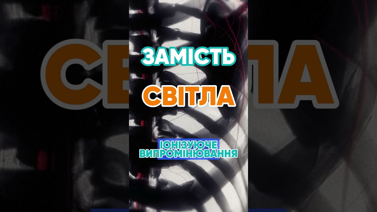 Чому рентген показує кістки? 🦴 #наука #цікаво #рентген #медицина