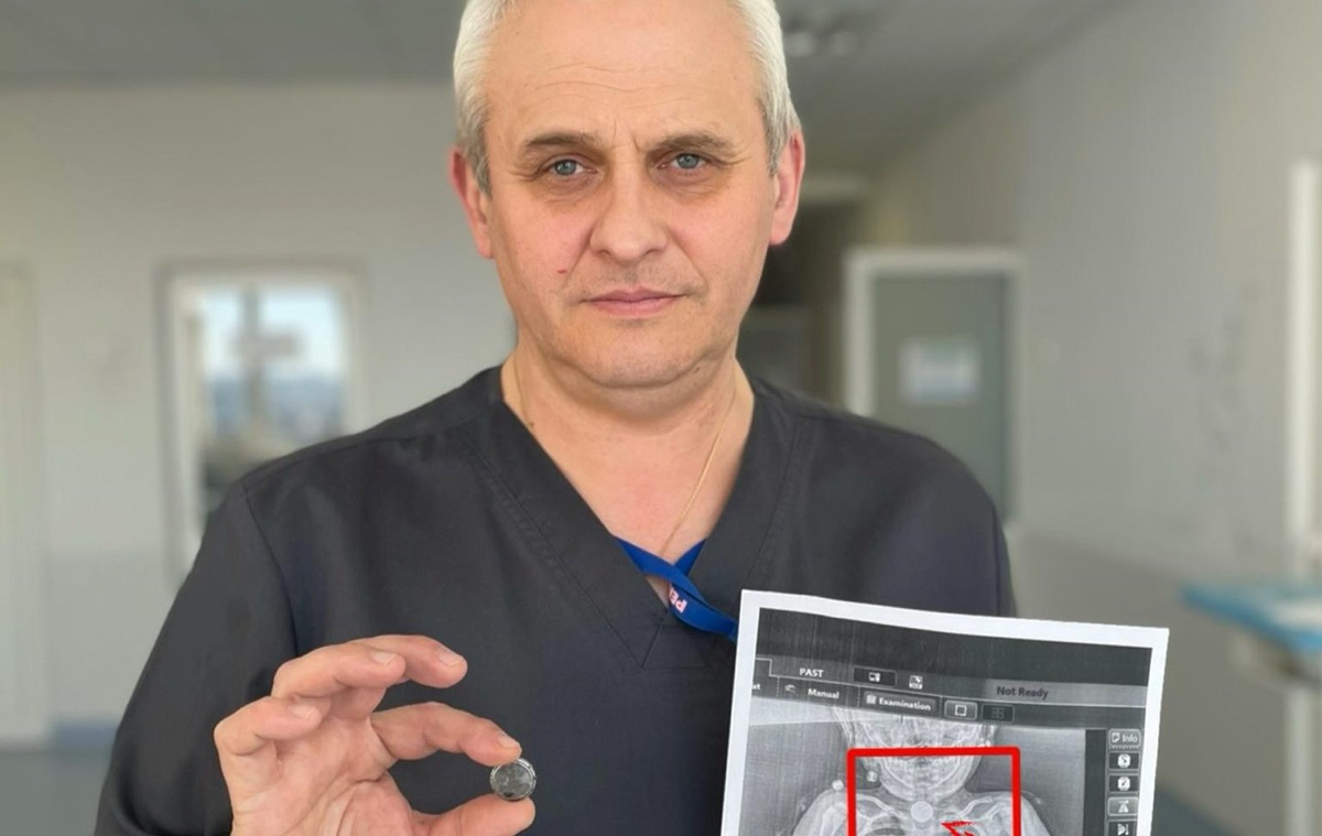 У Львові врятували дитину, яка місяцями жила з батарейкою у стравоході